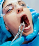 کشیدن دندان عقل توسط دکتر نازنین نوربخش