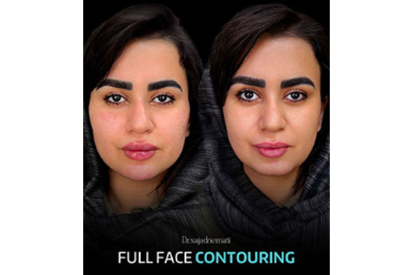 کانتورینگ تخصصی صورت توسط دکتر سجاد نعمتی