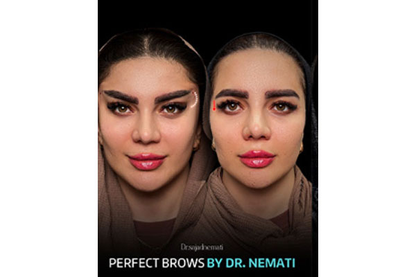 چه افرادی بهترین نتیجه را از لیفت ابرو با نخ می‌گیرند؟