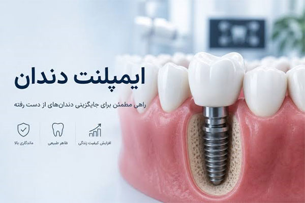 مراحل کاشت ایمپلنت دندان