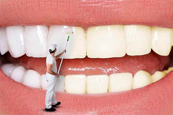 بلیچینگ یا سفید کردن دندان چیست؟