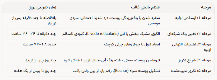 جدول زمانی مراحل پیشرفت علائم