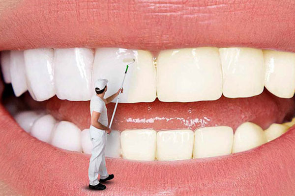 ویژگی های جرم گیری دندان