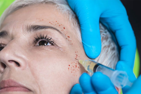 پی‌آر‌پی چه مزیت‌هایی دارد؟