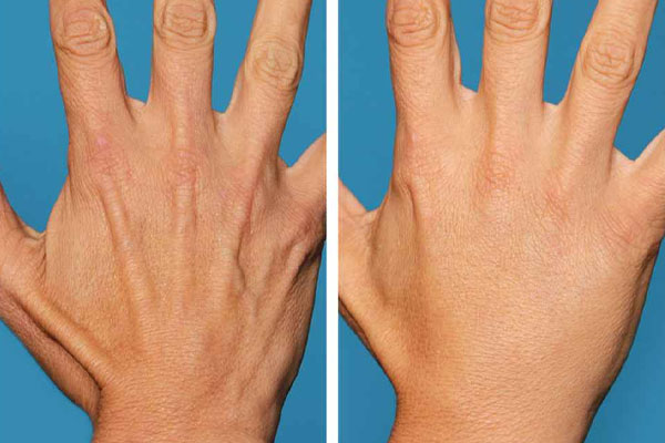 علت پیری دست‌ها کدامند؟