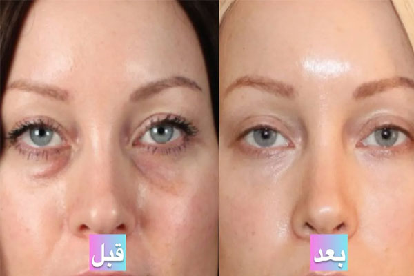پیآرپی چه مزیتهایی دارد؟