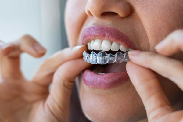 ارتودنسی نامرئی چیست؟