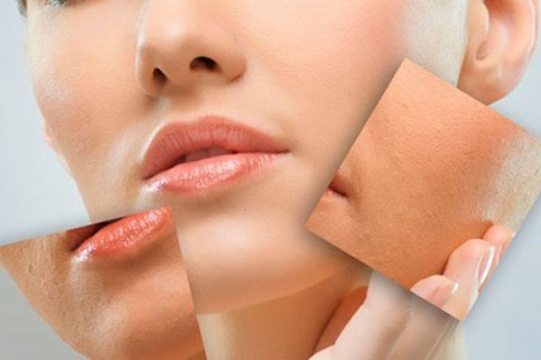 مهمترین مزایای فیس آپ