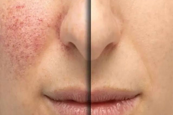 ضایعات عروقی چیست و چرا ایجاد می‌شوند؟