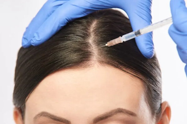 مزایای هیر فیلر چیست؟