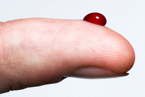 علائم بیماری غلظت خون