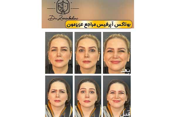 دکتر زرین بادینی - مرکز زیبایی پوست و مو