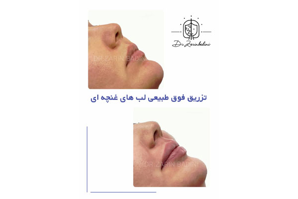 معرفی دکتر زرین بادینی