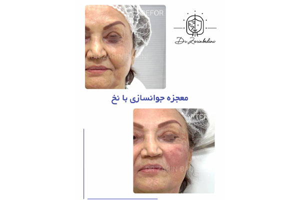 دکتر زرین بادینی - مرکز زیبایی پوست و مو