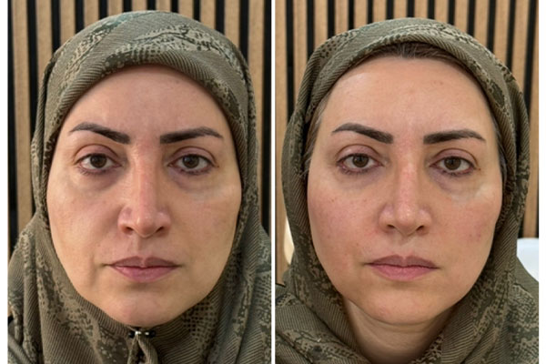 دکتر علیرضا رفیعی - پوست، مو و زیبایی