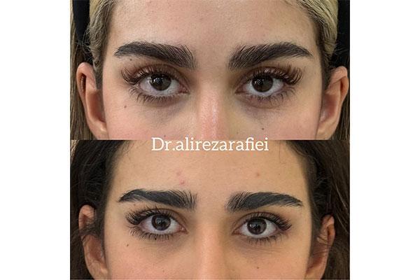 دکتر علیرضا رفیعی - پوست، مو و زیبایی