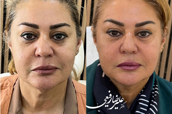 دکتر علیرضا رفیعی - پوست، مو و زیبایی