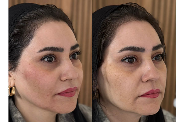 دکتر علیرضا رفیعی - پوست، مو و زیبایی