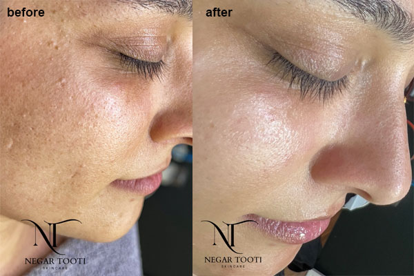 چرا مرکز تخصصی فیشیال نگار طوطی انتخاب مناسبی است؟