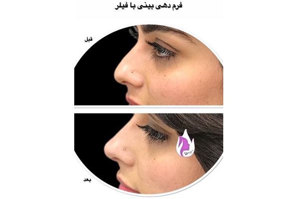 دکتر سید علی اکبر داور پناه - پزشک زیبایی، پوست و مو