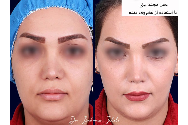 چه زمانی باید برای جراحی ترمیمی اقدام کرد؟