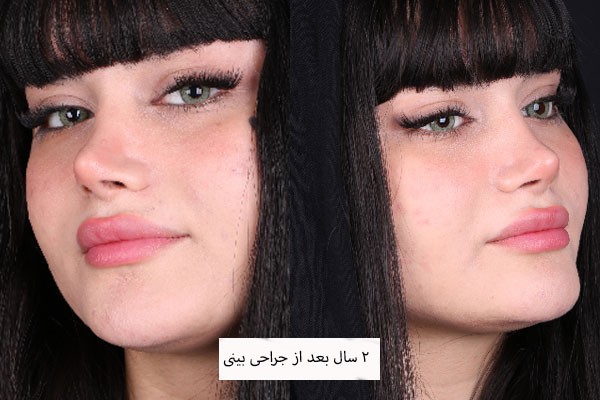 تفاوت اصلی میان عمل بینی فانتزی و نیمه فانتزی