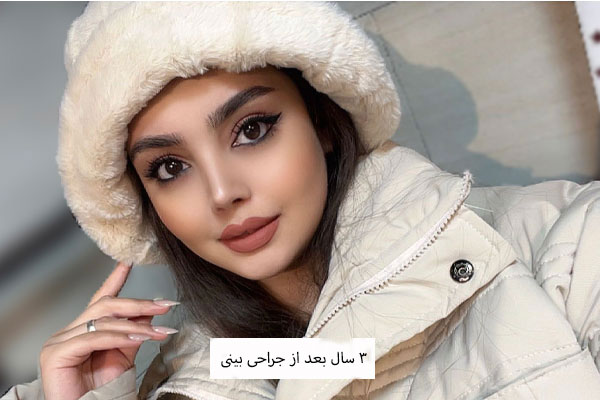 عمل بینی نیمه فانتزی