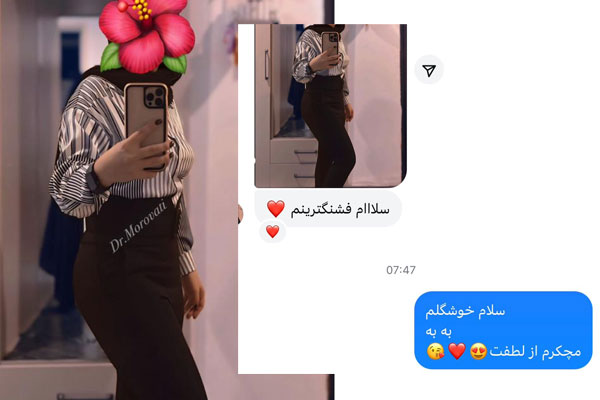 مزایای انجام لیپوماتیک و ابدومینوپلاستی به صورت همزمان