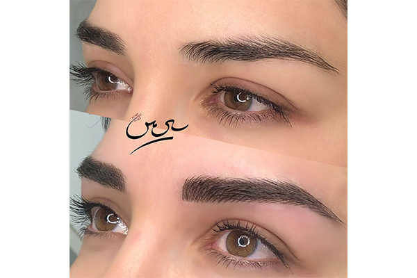 مقایسه میکروبلیدینگ و فیبروز ابرو