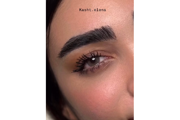 نکات مهم قبل و بعد از کاشت ابرو