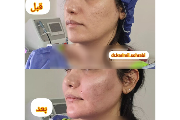 دکتر مژگان کریمی - پوست و مو، زیبایی و لیزر