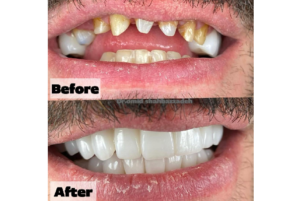 نکات مهم قبل از مراجعه به دندانپزشکی