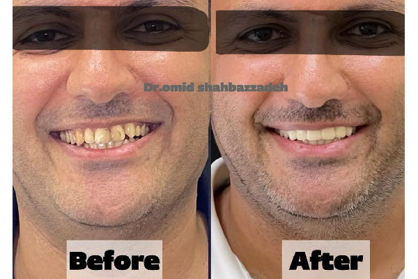 خدمات تخصصی دندانپزشکی در کلینیک دندانپزشکی دکتر امید شهباززاده 