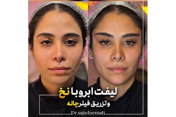 دکتر سجاد نعمتی - پوست ، مو و زیبایی