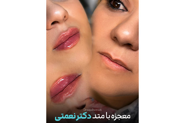دکتر سجاد نعمتی - پوست ، مو و زیبایی