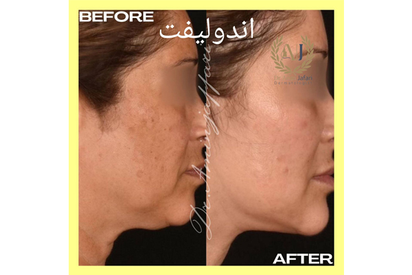 دکتر امین جعفری - متخصص پوست، مو و زیبایی