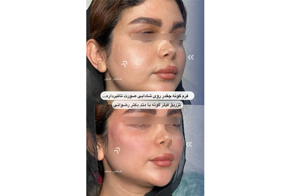 دکتر علی رضوانی - پزشک زیبایی