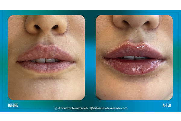 دکتر فواد متولی زاده - پوست مو و زیبایی