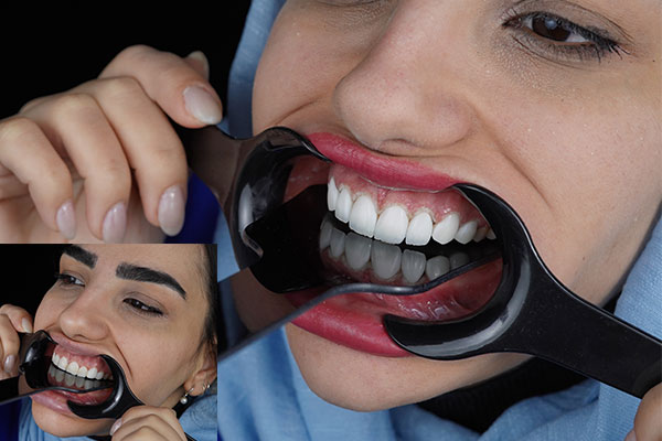 مرکز دندانپزشکی هومینا پلاس