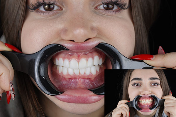 مرکز دندانپزشکی هومینا پلاس