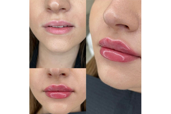 دکتر مریم شهسواری - پوست، مو و لیزر 