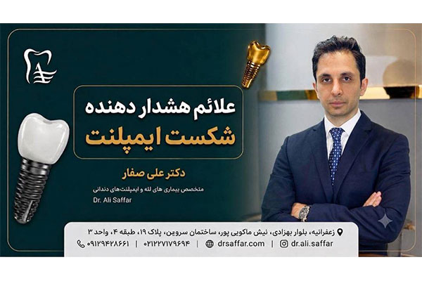 دندانپزشکی دکتر علی صفار - ایمپلنت دیجیتال