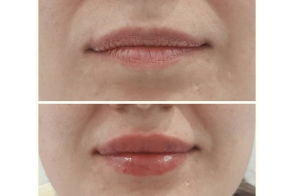 دکتر سیمین صرافی - متخصص پوست و مو، لیزر و زیبایی