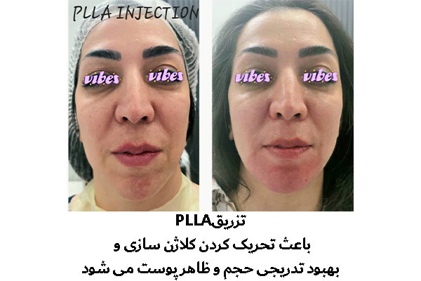 دکتر سیمین صرافی - متخصص پوست و مو، لیزر و زیبایی