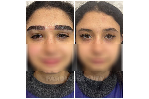 کلینیک زیبایی پارسیان بیوتی