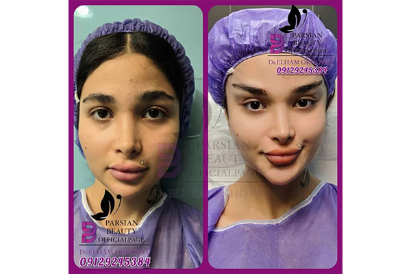 مرکز زیبایی و جوانسازی پارسیان بیوتی