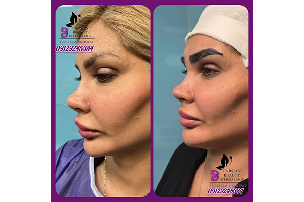 مرکز زیبایی و جوانسازی پارسیان بیوتی