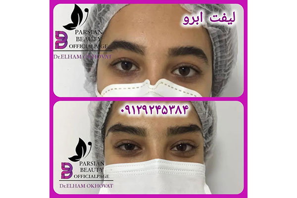 مرکز زیبایی و جوانسازی پارسیان بیوتی