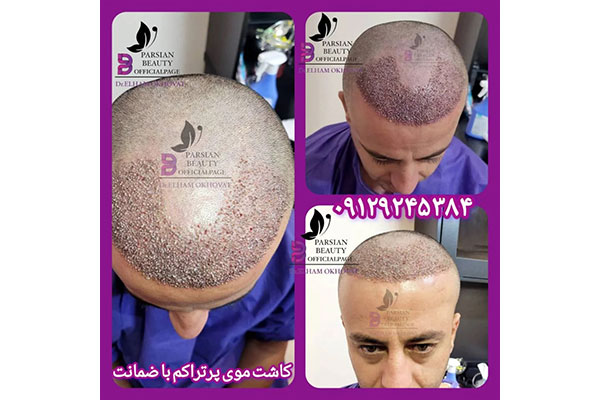 مرکز زیبایی و جوانسازی پارسیان بیوتی