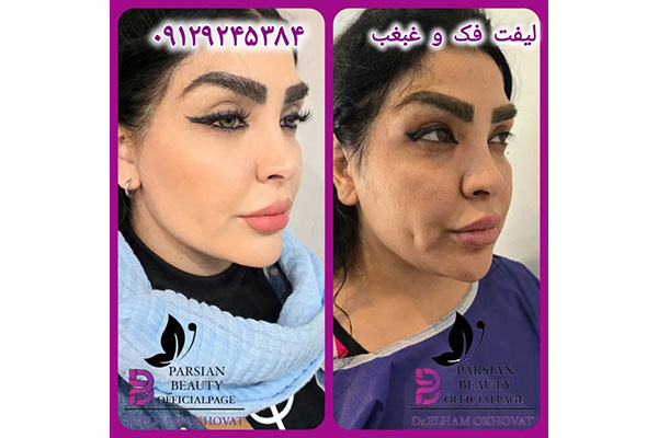 مرکز زیبایی و جوانسازی پارسیان بیوتی